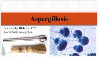 •Described by Micheli in 1729.
•Resembled to Aspergillum.
15
Aspergillosis
 