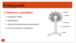 Pathogenesis
19
1. Pulmonary aspergillosis
a. Aspergillus asthma
b. Aspergilloma
c. Allergic bronchopulmonary aspergillosis
d. Invasive pulmonary aspergillosis
 