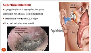 22
Superficial infection:
Aspergillus flavus & Aspergillus fumigatus
colonise in part of nasal sinuses (sinusitis).
 External ear (otomycosis): A. niger
Skin, nail and other sites aswell.
 
