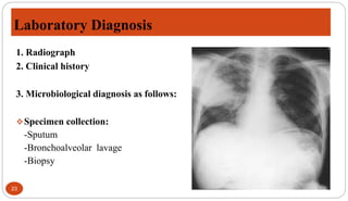 Laboratory Diagnosis
23
1. Radiograph
2. Clinical history
3. Microbiological diagnosis as follows:
Specimen collection:
-Sputum
-Bronchoalveolar lavage
-Biopsy
 