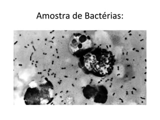 Amostra de Bactérias:
 