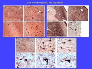Common chimpanzee, Pan troglodytes