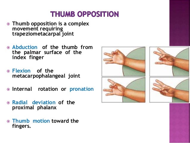 Ape thumb deformity to publish