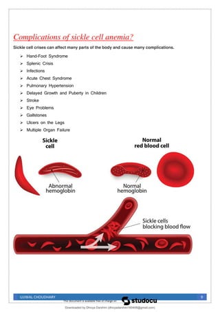 UJJWAL CHOUDHARY 9
Complications of sickle cell anemia?
Sickle cell crises can affect many parts of the body and cause many complications.
➢ Hand-Foot Syndrome
➢ Splenic Crisis
➢ Infections
➢ Acute Chest Syndrome
➢ Pulmonary Hypertension
➢ Delayed Growth and Puberty in Children
➢ Stroke
➢ Eye Problems
➢ Gallstones
➢ Ulcers on the Legs
➢ Multiple Organ Failure
Downloaded by Dhivya Darshini (dhivyadarshini160408@gmail.com)
lOMoARcPSD|41270447
 
