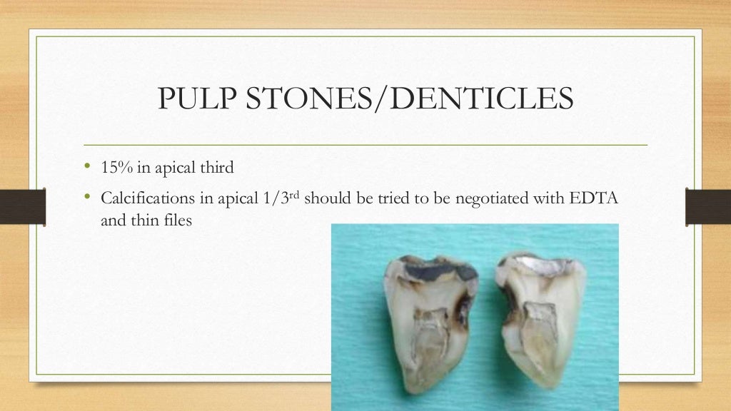 apex endodontics apex endodontics