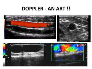 DOPPLER - AN ART !!
 