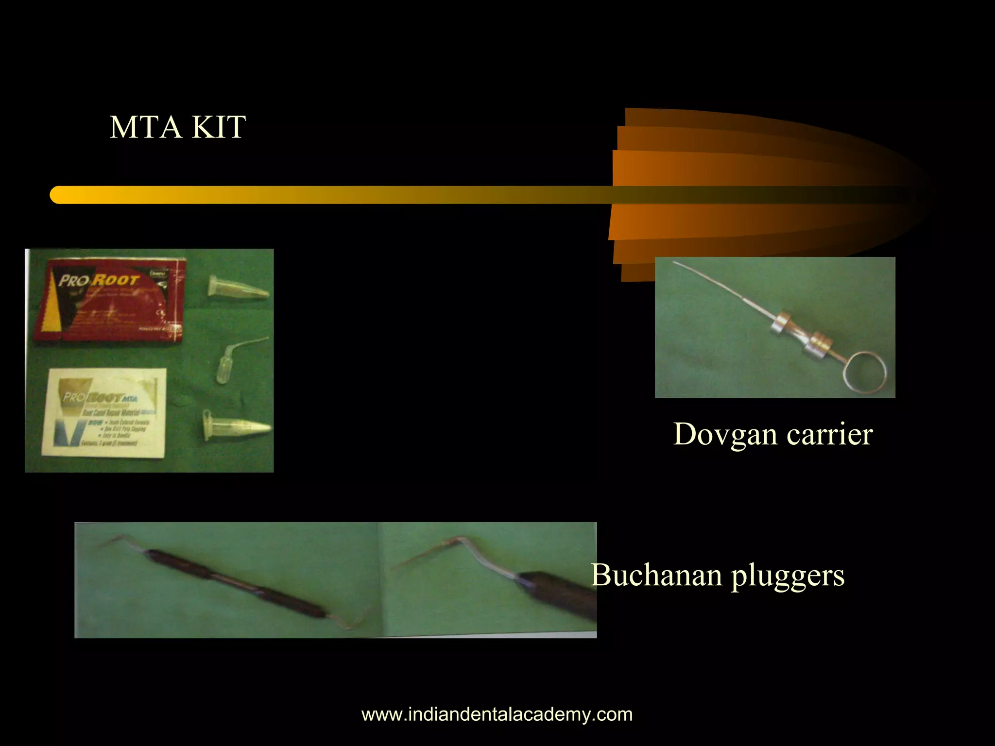 Dovgan carrier
Buchanan pluggers
MTA KIT
www.indiandentalacademy.com
 