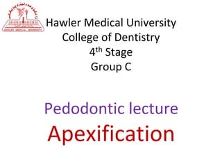 Hawler Medical University
College of Dentistry
4th Stage
Group C
Pedodontic lecture
Apexification
 