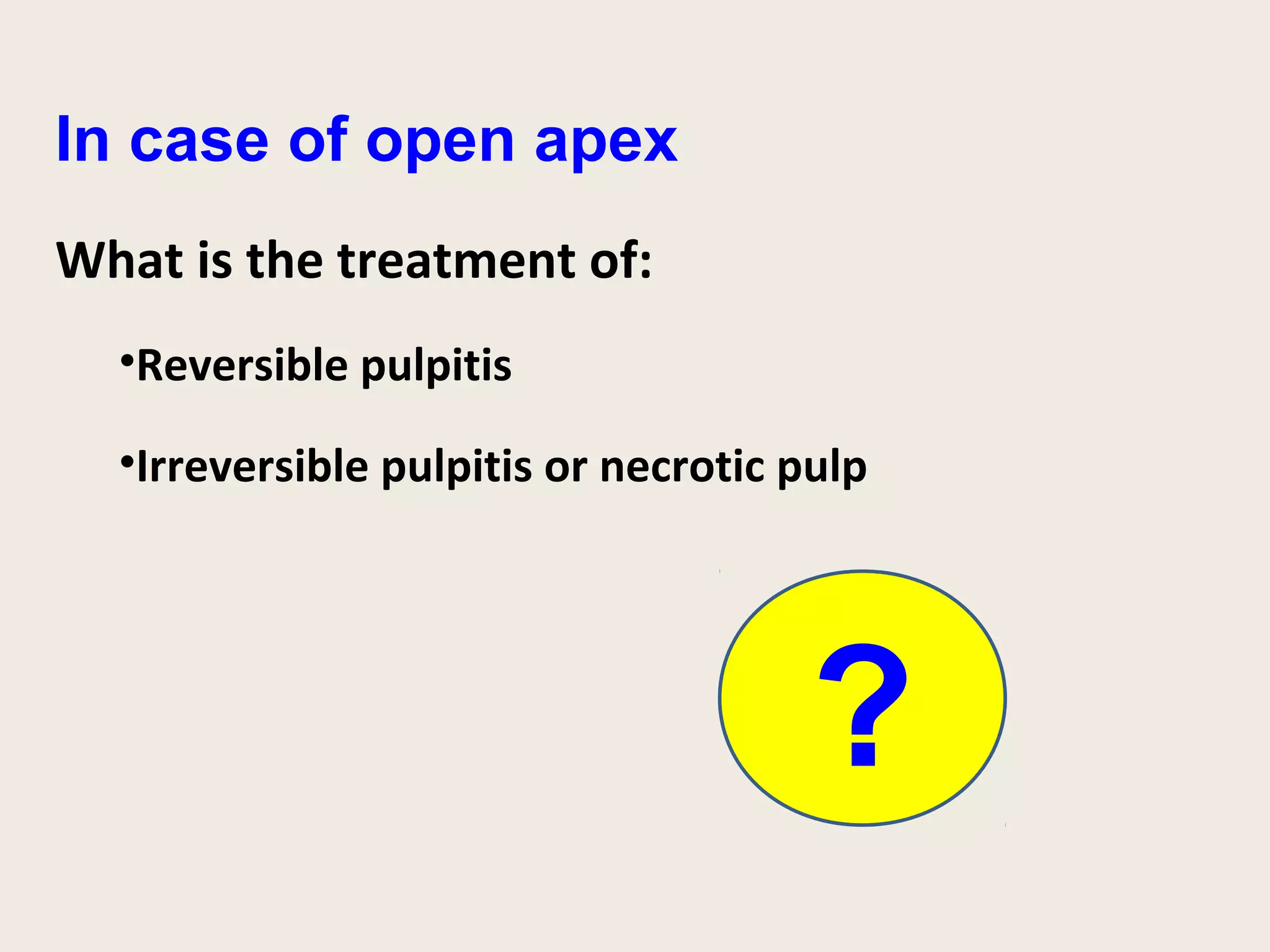 In case of open apex
What is the treatment of:
  •Reversible pulpitis

  •Irreversible pulpitis or necrotic pulp




                                      ?
 