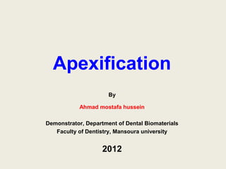 Apexification
                      By

           Ahmad mostafa hussein

Demonstrator, Department of Dental Biomaterials
   Faculty of Dentistry, Mansoura university


                    2012
 