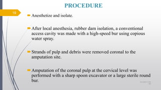PROCEDURE
Anesthetize and isolate.
After local anesthesia, rubber dam isolation, a conventional
access cavity was made with a high-speed bur using copious
water spray.
Strands of pulp and debris were removed coronal to the
amputation site.
Amputation of the coronal pulp at the cervical level was
performed with a sharp spoon excavator or a large sterile round
bur.
19
10/12/2017 4:59
AM
 