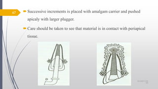 Successive increments is placed with amalgam carrier and pushed
apicaly with larger plugger.
Care should be taken to see that material is in contact with periapical
tissue.
47
10/12/2017 4:59
AM
 