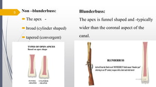 Non –blunderbuss:
The apex -
broad (cylinder shaped)
tapered (convergent)
5 Blunderbuss:
The apex is funnel shaped and -typically
wider than the coronal aspect of the
canal.
10/12/2017 4:59
AM
 