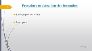 Procedure to detect barrier formation
Radiographic evaluation
Paper point
51
10/12/2017 4:59
AM
 