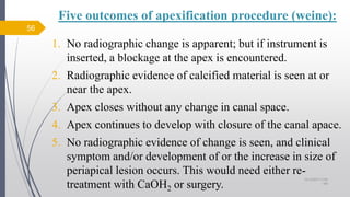 Five outcomes of apexification procedure (weine):
1. No radiographic change is apparent; but if instrument is
inserted, a blockage at the apex is encountered.
2. Radiographic evidence of calcified material is seen at or
near the apex.
3. Apex closes without any change in canal space.
4. Apex continues to develop with closure of the canal apace.
5. No radiographic evidence of change is seen, and clinical
symptom and/or development of or the increase in size of
periapical lesion occurs. This would need either re-
treatment with CaOH2 or surgery.
56
10/12/2017 4:59
AM
 