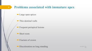 Problems associated with immature apex
 Large open apices
 Thin dentinal walls
 Frequent periapical lesions
 Short roots
 Fracture of crown
 Discoloration on long standing
9
10/12/2017 4:59
AM
 