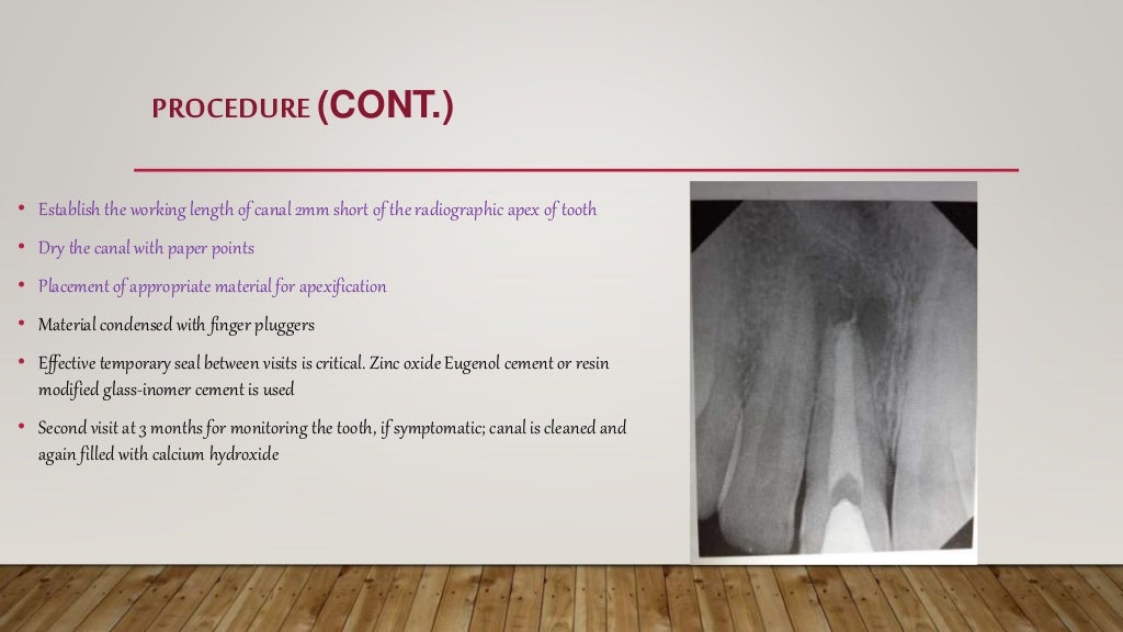 Apexification and Apexogenesis