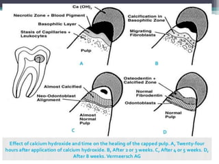 Apexification & apexogenesis | PPTX