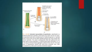 APEXOGENESIS AND APEXIFICATION.pptx