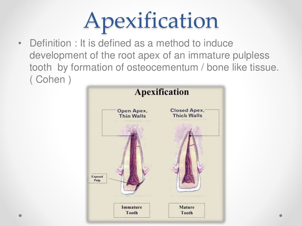 Apexogenesis & apexification in pediatric dentistry