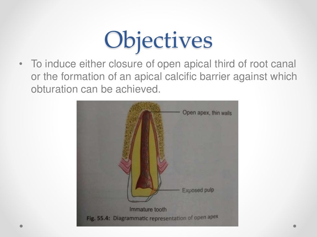 Apexogenesis & apexification in pediatric dentistry