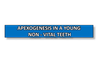 APEXOGENESIS IN A YOUNG
NON - VITAL TEETH
 