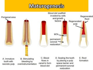 Maturogenesis
 