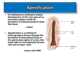 Apexification
• It is defined as a method to induce
development of the root apex of an
immature pulpless tooth by
formation of osteocementum/ bone
like tissue
-cohen
• Apexification is a method of
inducing apical closure through the
formation of mineralized tissue in
the apical pulp region of a non-vital
tooth with an incompletetly formed
root and an open apex
-morse etal 1990
 