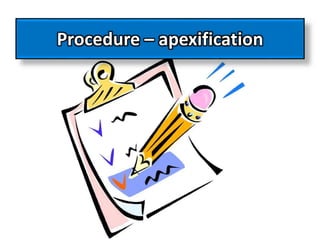 Procedure – apexification
 