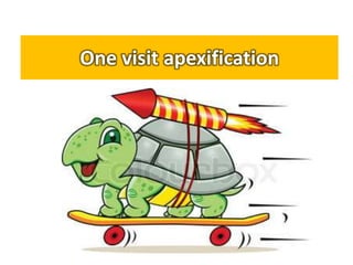 One visit apexification
 