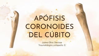 APÓFISIS
CORONOIDES
DEL CÚBITO
- Juárez Olivo Denisse
- Traumatología y ortopedia II
 