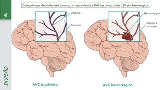 41
DIVISÃO Os isquêmicos são muito mais comuns, correspondendo a 85% dos casos, contra 15% dos hemorrágicos
 