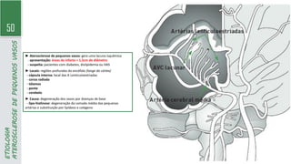 50
ETIOLOGIA
ATEROSCLEROSE
DE
PEQUENOS
VASOS
► Aterosclerose de pequenos vasos: gera uma lacuna isquêmica
- apresentação: áreas de infarto < 1,5cm de diâmetro
- suspeita: pacientes com diabetes, dislipidemia ou HAS
► Locais: regiões profundas do encéfalo (longe do córtex)
- cápsula interna: local das A Lenticuloestriadas
- coroa radiada
- tálamos
- ponte
- cerebelo
► Causa: degeneração dos vasos por doenças de base
- lipo-hialinose: degeneração da camada média das pequenas
artérias e substituição por lipídeos e colágeno
 