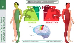 60
MANIFESTAÇÕES
CLÍNICAS
HOMÚNCULO
DE
PENFIELD
► ACM: déficits motor (hemiparesia) e sensitivo de predomínio braquiofacial
► ACA: déficits motor (hemiparesia) e sensitivo de predomínio crural
 