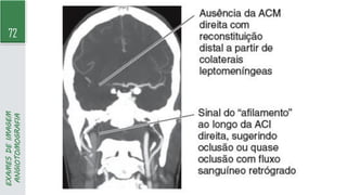 72
EXAMES
DE
IMAGEM
ANGIOTOMOGRAFIA
 