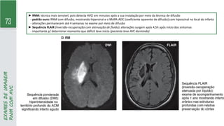 73
EXAMES
DE
IMAGEM
RNM
COM
AVC
► RNM: técnica mais sensível, pois detecta AVCi em minutos após a sua instalação por meio da técnica de difusão
- padrão ouro: RNM com difusão, mostrando hipersinal e o MAPA-ADC (coeficiente aparente de difusão) com hipossinal no local do infarto
- alterações permanecem até 4 semanas no exame por meio de difusão
► Sequência FLAIR (inversão-recuperação com atenuação de fluido): alterações surgem após 4,5h após início dos sintomas
- importante p/ determinar momento que déficit teve início (paciente teve AVC dormindo)
 