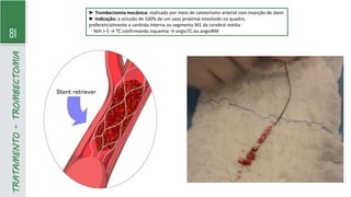 81
TRATAMENTO
-
TROMBECTOMIA
► Trombectomia mecânica: realizado por meio de cateterismo arterial com inserção de stent
► Indicação: a oclusão de 100% de um vaso proximal envolvido no quadro,
preferencialmente a carótida interna ou segmento M1 da cerebral média
- NIH > 5 → TC confirmando isquemia → angioTC ou angioRM
 