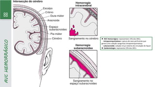 88
AVC
HEMORRÁGICO
► AVC Hemorrágico: representam 15% dos AVCs
- intraparenquimatoso: ruptura de vaso perfurante que
gerará uma coleção sanguínea intraparenquimatosa
- subaracnoide: coleção irá p/ sistema de circulação do líquor
► Epidemiologia: representa 15% dos AVCs
 