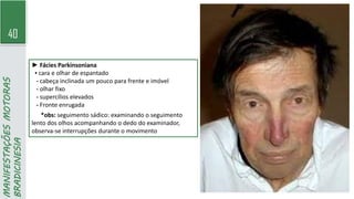 40
MANIFESTAÇÕES
MOTORAS
BRADICINESIA
► Fácies Parkinsoniana
▪ cara e olhar de espantado
- cabeça inclinada um pouco para frente e imóvel
- olhar fixo
- supercílios elevados
- Fronte enrugada
*obs: seguimento sádico: examinando o seguimento
lento dos olhos acompanhando o dedo do examinador,
observa-se interrupções durante o movimento
 
