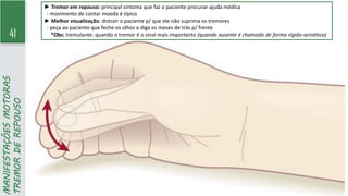 41
MANIFESTAÇÕES
MOTORAS
TREMOR
DE
REPOUSO
► Tremor em repouso: principal sintoma que faz o paciente procurar ajuda médica
- movimento de contar moeda é típico
► Melhor visualização: distrair o paciente p/ que ele não suprima os tremores
- peça ao paciente que feche os olhos e diga os meses de trás p/ frente
*Obs: tremulante: quando o tremor é o sinal mais importante (quando ausente é chamado de forma rígido-acinética)
 