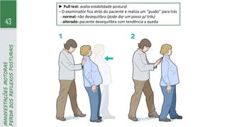 43
MANIFESTAÇÕES
MOTORAS
PERDA
DOS
REFLEXOS
POSTURAIS
► Pull test: avalia estabilidade postural
- O examinador fica atrás do paciente e realiza um “puxão” para trás
- normal: não desequilibra (pode dar um passo p/ trás)
- alterado: paciente desequilibra com tendência a queda
 