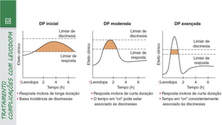 68
TRATAMENTO
COMPLICAÇÕES
COM
LEVODOPA
 