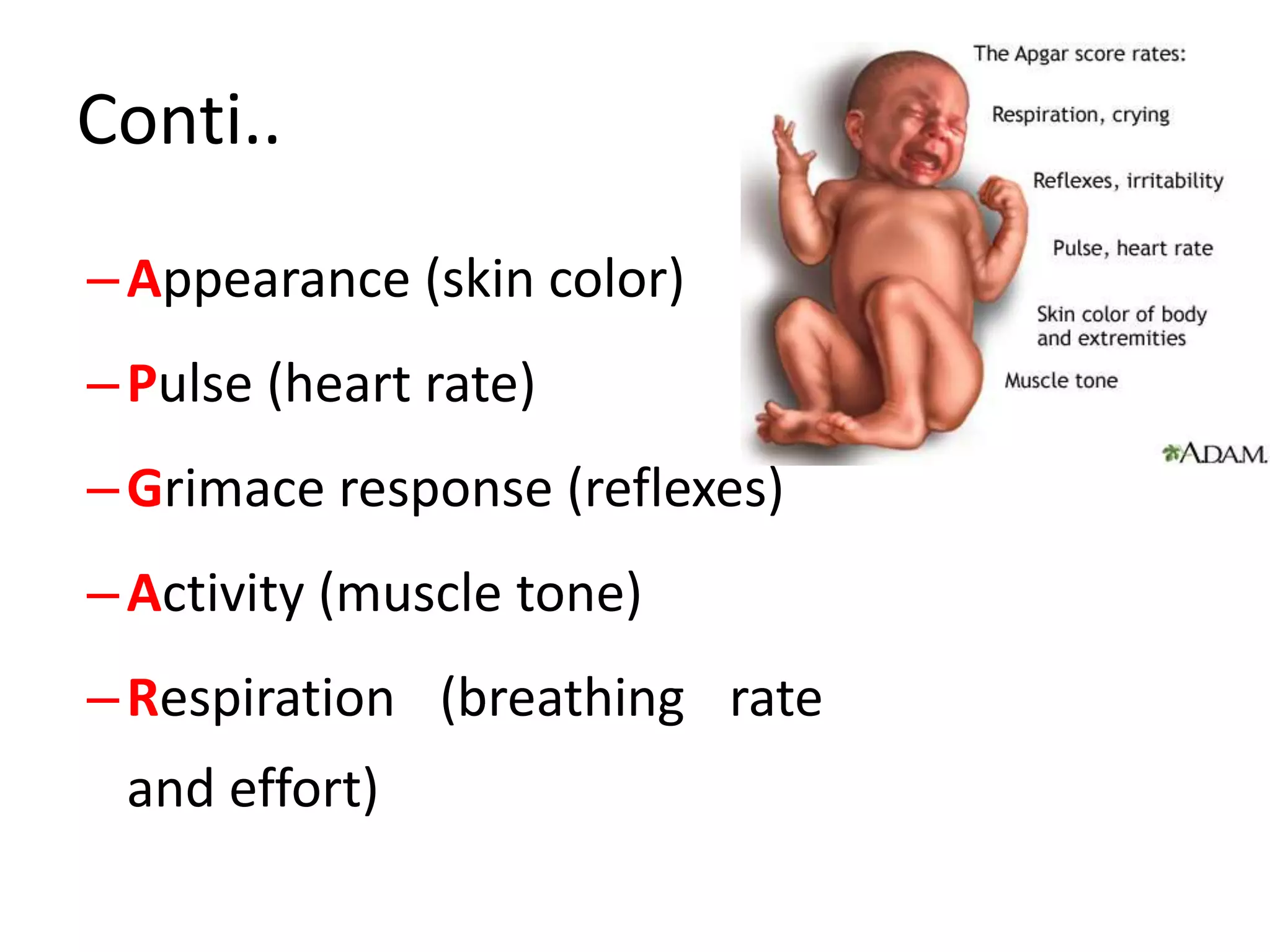 Apgar score | PPTX