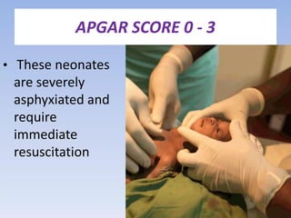 Beyond the First Breath: A Clinical Guide to the APGAR Score & Neonatal ...