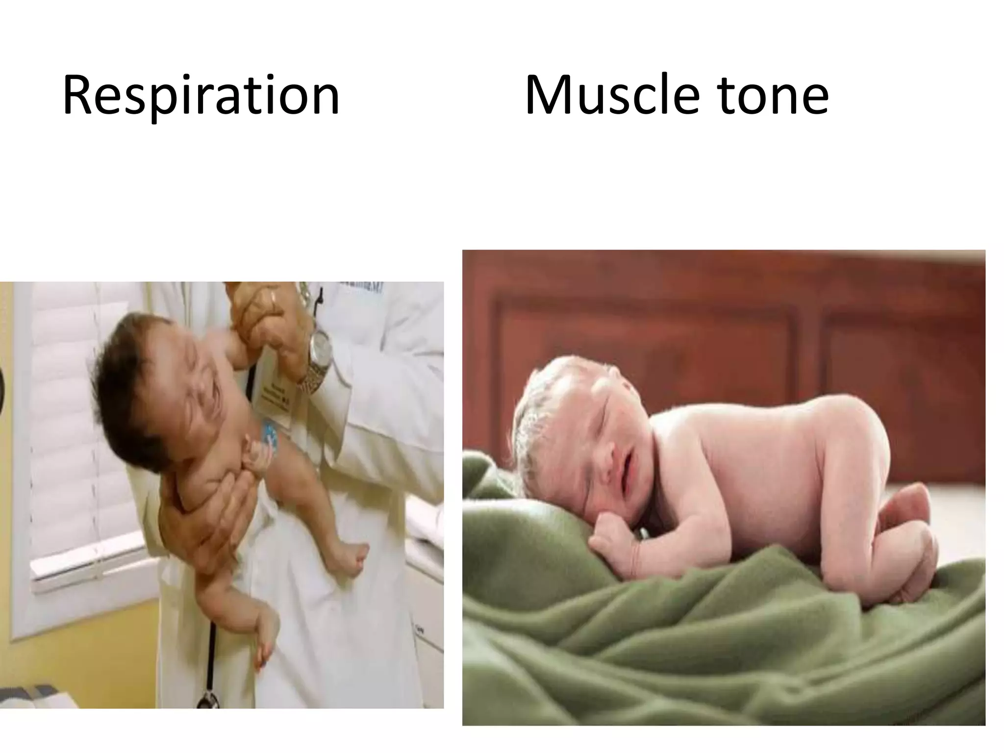 Respiration Muscle tone
 