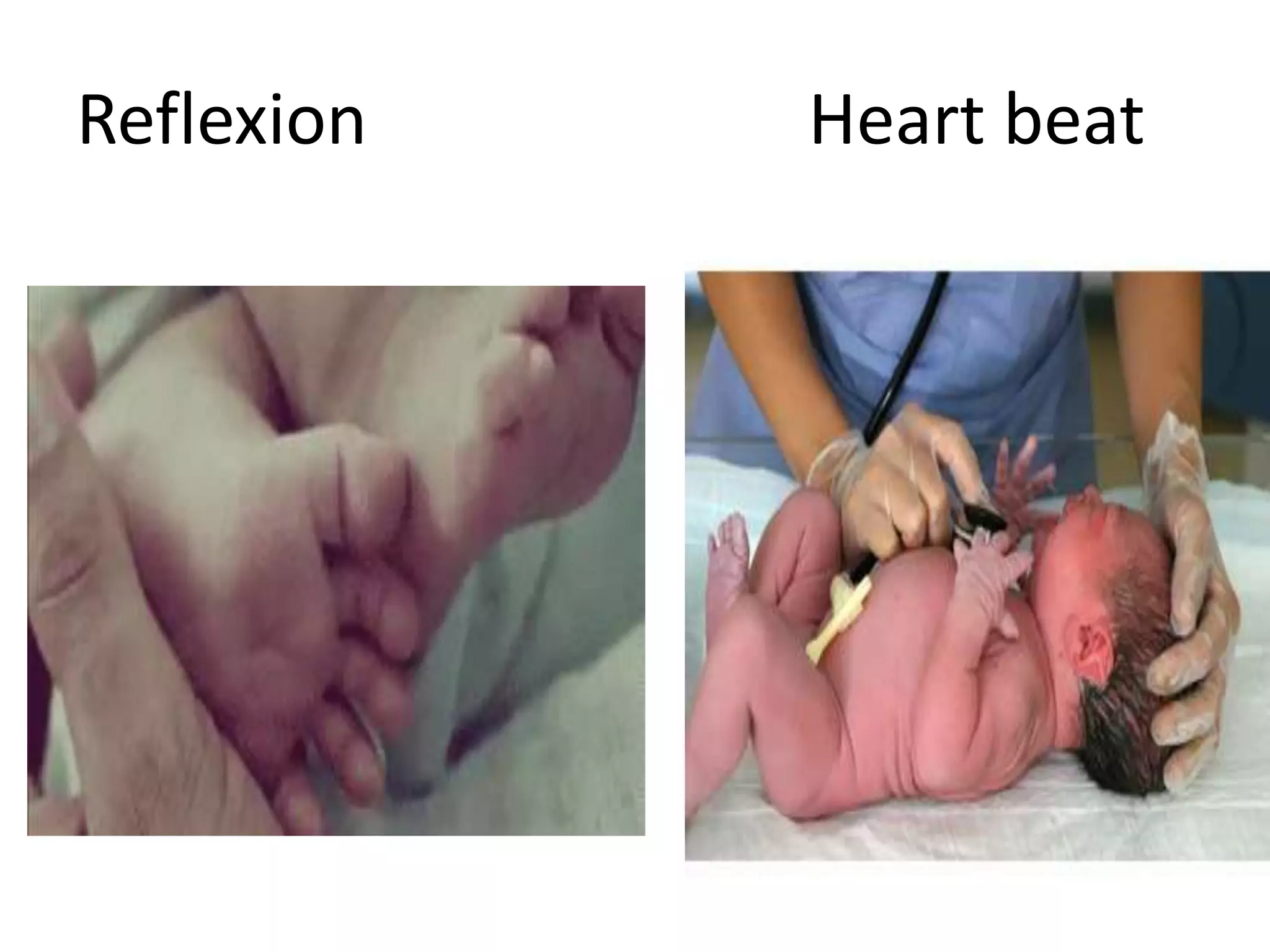 Reflexion Heart beat
 