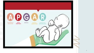 APGAR SCORE appearance, pulse rate,grimace,activityand respiration | PPTX