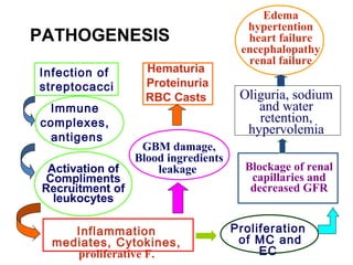 Immune
complexes,
antigens
Activation of
Compliments
Recruitment of
leukocytes
GBM damage,
Blood ingredients
leakage
Hematuria
Proteinuria
RBC Casts
Proliferation
of MC and
EC
Blockage of renal
capillaries and
decreased GFR
Edema
hypertention
heart failure
encephalopathy
renal failure
Oliguria, sodium
and water
retention,
hypervolemia
Inflammation
mediates, Cytokines,
proliferative F.
Infection of
streptocacci
PATHOGENESIS
 