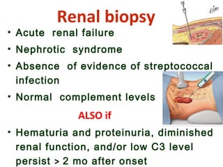 Renal biopsy
• Acute renal failure
• Nephrotic syndrome
• Absence of evidence of streptococcal
infection
• Normal complement levels
ALSO if
• Hematuria and proteinuria, diminished
renal function, and/or low C3 level
persist > 2 mo after onset
 