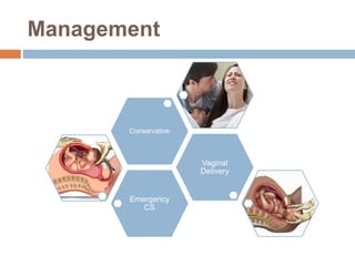 Management
Emergency
CS
Vaginal
Delivery
Conservative
 